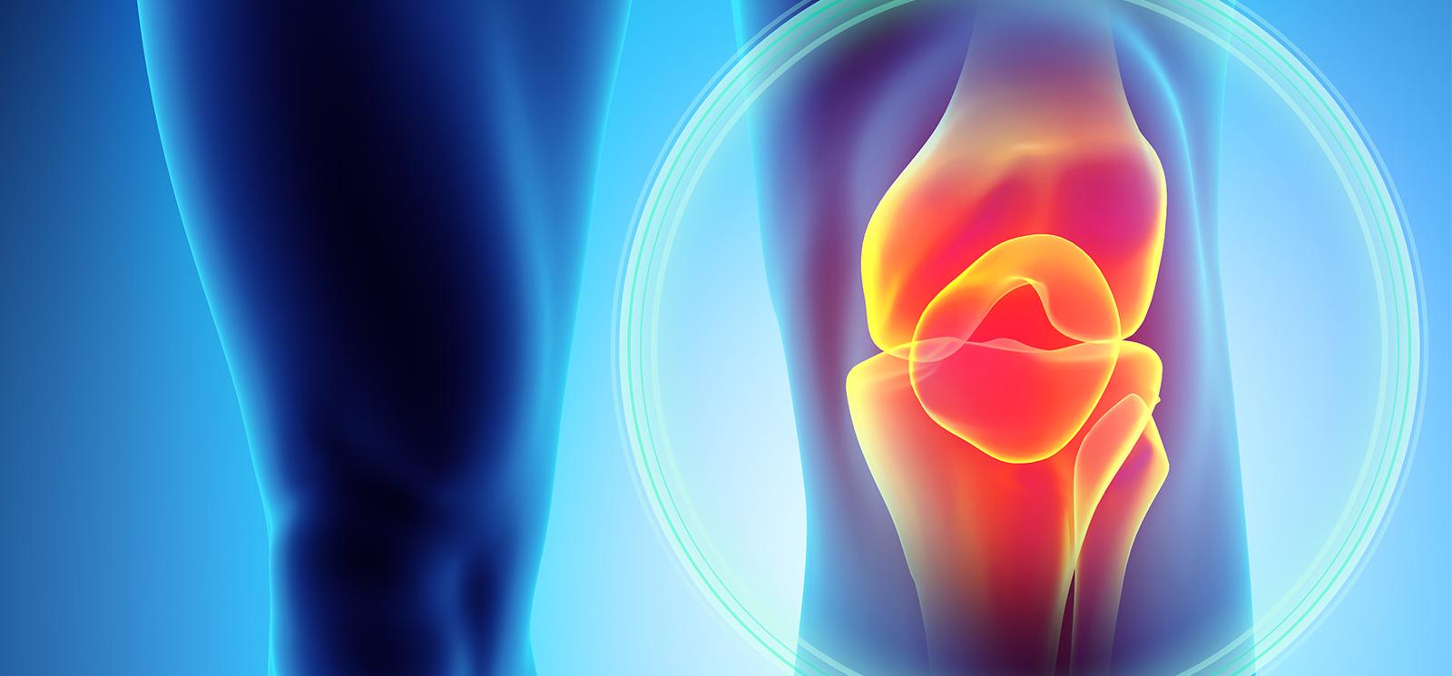 The Value of Joint Replacement for Patients with Osteoarthritis